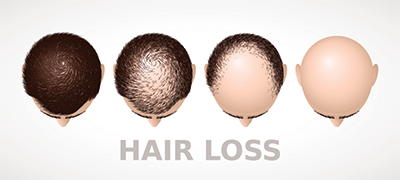 Hair Restoration
